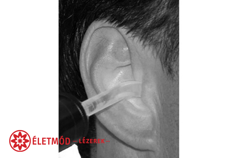 izületi deformáció kezelése életmód lézerrel