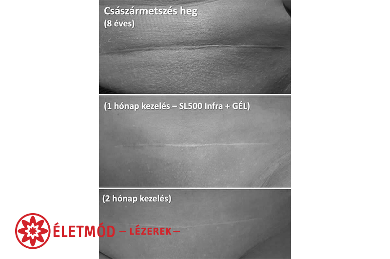 Safe Laser 150